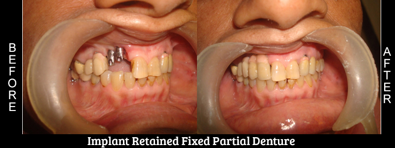 Before Cosmetic Treatment