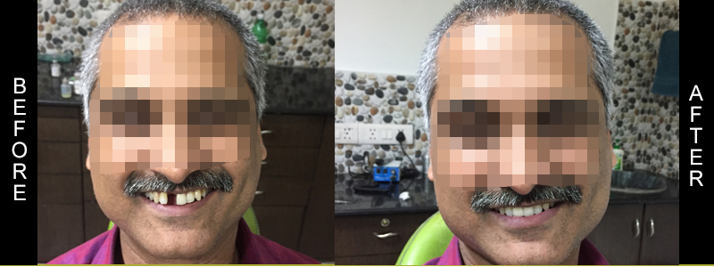 Before Cosmetic Treatment
