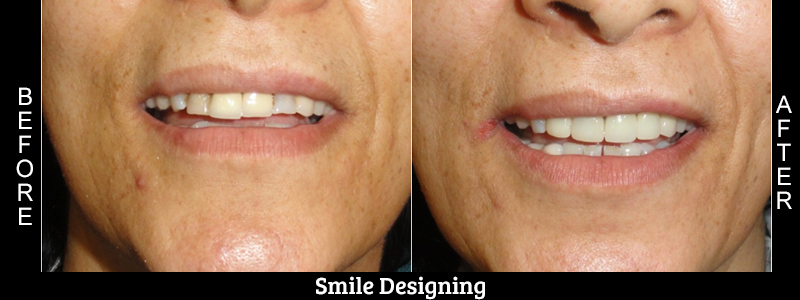 Before Cosmetic Treatment