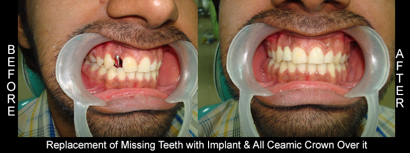 Before Cosmetic Treatment